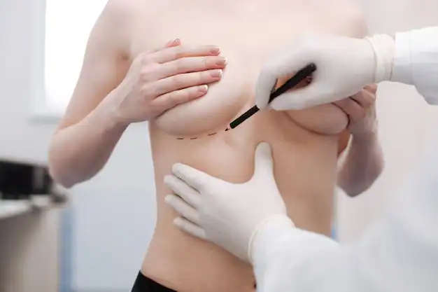 Breast Aesthetics in Turkey 29 Breast Augmentation turkey in istanbul cost