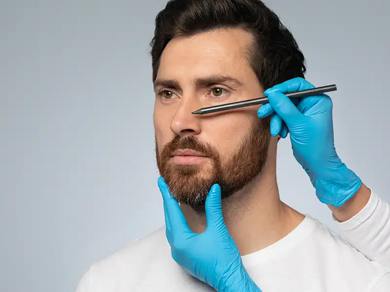 Rhinoplasty 30 Rhinoplasty What to